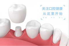 合肥哪里的种植牙好？挑选牙科要看这些条件
