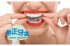 牙齿稀疏怎么矫正？