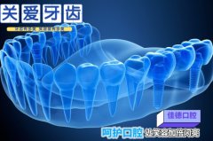 合肥种植牙价格表-一颗就很贵？