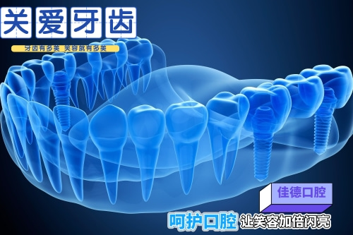 合肥种植牙、种植牙多少钱
