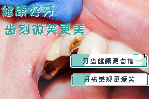 合肥佳德口腔、合肥根管的治疗