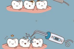 合肥治疗蛀了牙补牙多少钱？--补牙收费揭秘