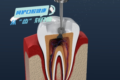 合肥补牙多少钱