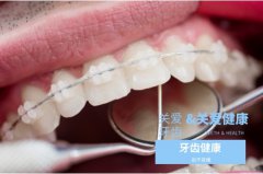 合肥矫正牙齿多少钱-线上领取专属优惠