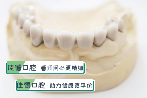 合肥整牙多少钱