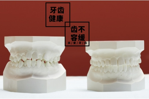 合肥牙齿矫正收费