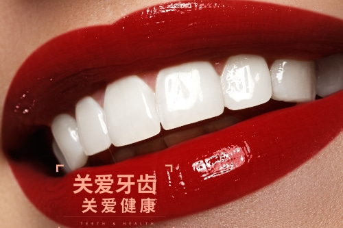 合肥牙齿贴面美白多少钱
