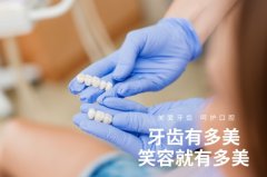 合肥牙齿美白贴面价格-收费标准公布