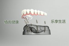 合肥植牙一颗大约多少费用-收费因素盘点