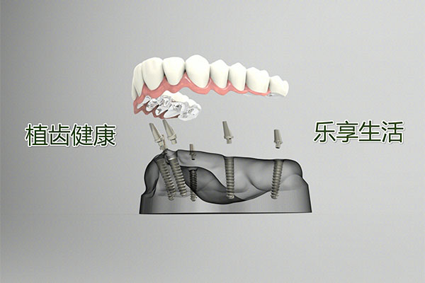 合肥种植牙哪个医院种的好