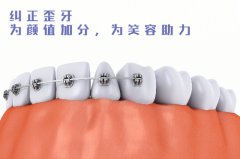 合肥口腔正畸好的医院-牙齿矫正技术好的牙科